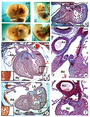 Figure 1: Cardiac defects in mutant mice...